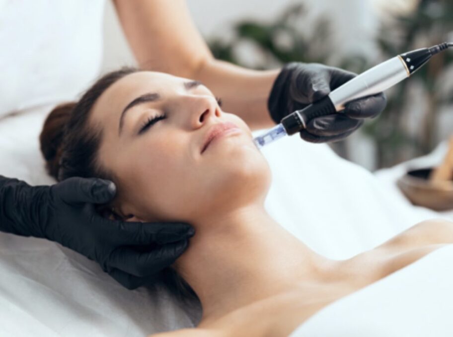 Microneedling