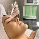 Hydrodermabrasion.jpg-2